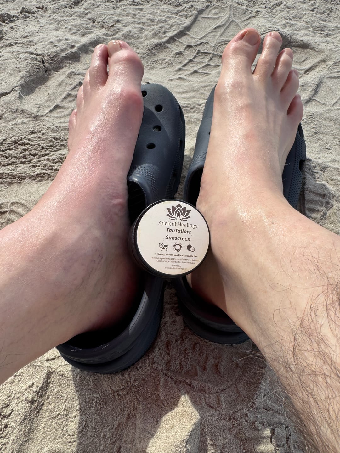 Customer photo review of TanTallow Mineral Sunscreen