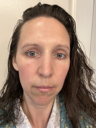 Customer photo review of Nutriskin LED Face Mask - Red Light Therapy for Wrinkles + FREE Neck Mask ($169 Value)