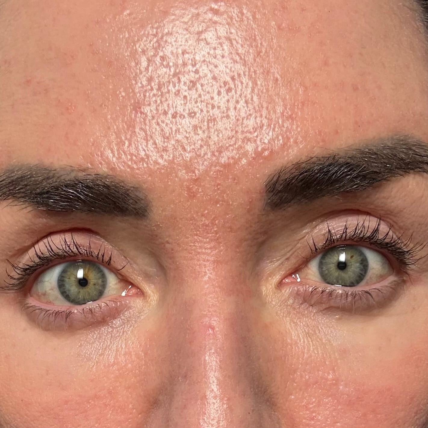 Customer photo review of NEW & IMPROVED LASH SERUM