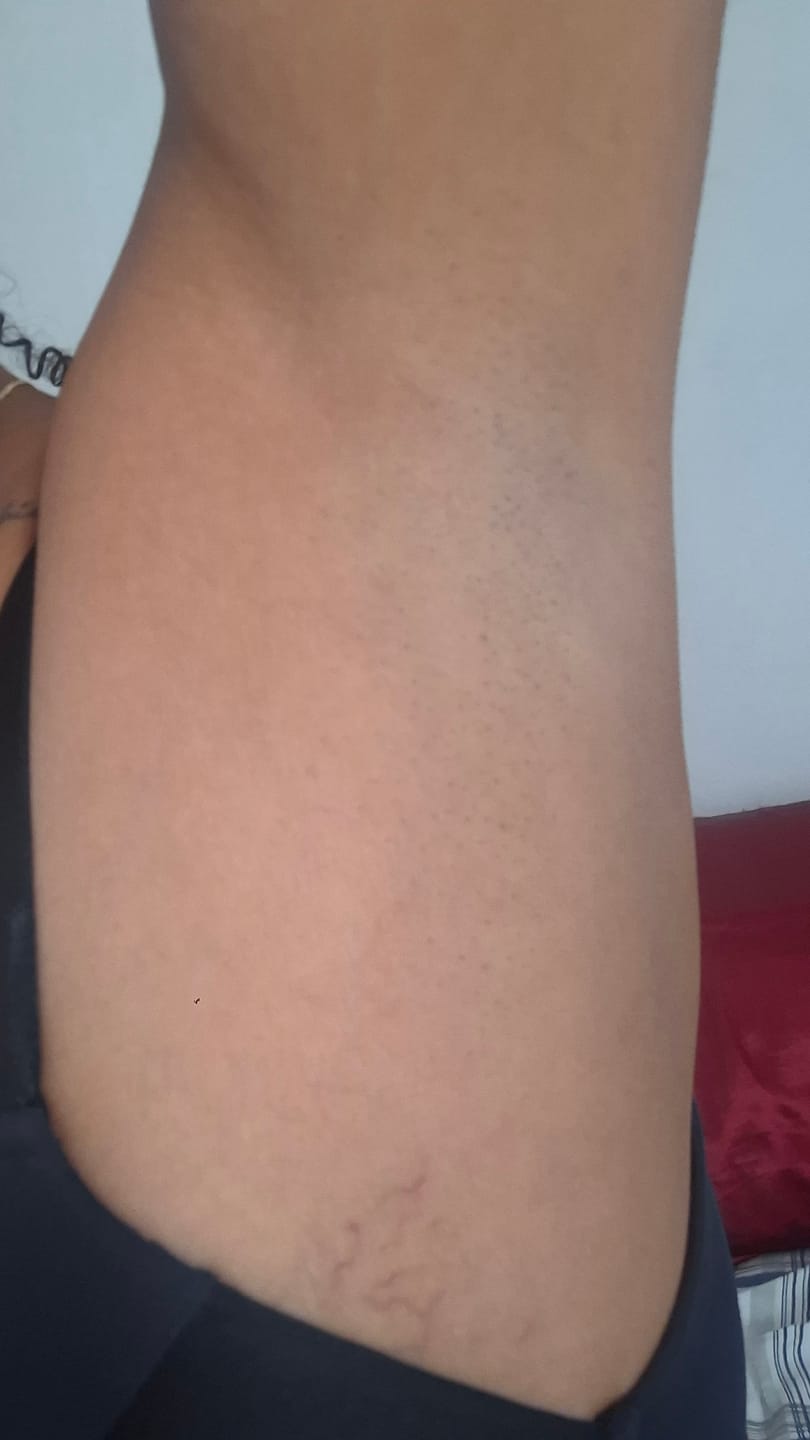 Customer photo review of Kit Clareamento Total + 1 Firmador de Brinde