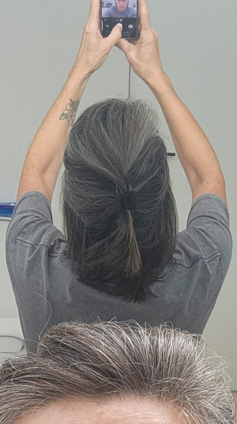 Customer photo review of Rosemary & Castor Hair Oil - Grow hair 5X faster