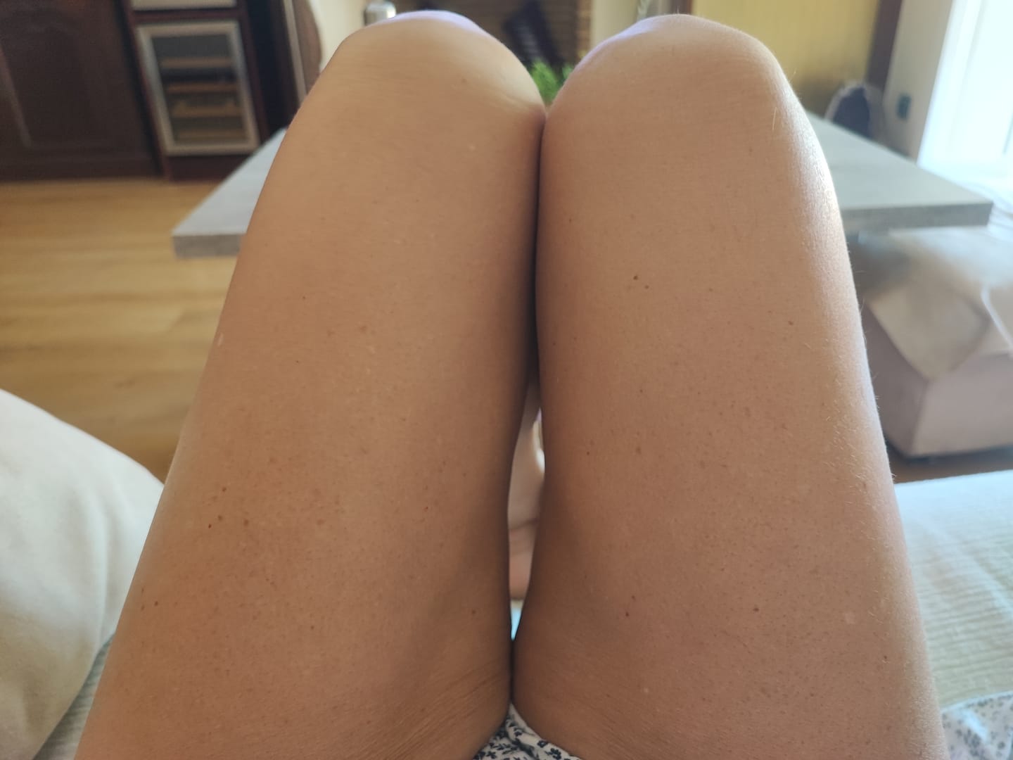 Customer photo review of Probio 6 Body Lotion