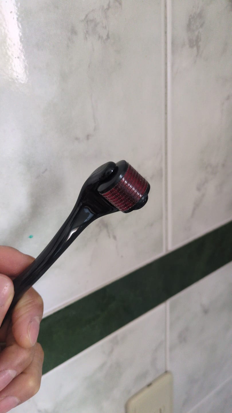 Customer photo review of Dermarroller 0,5 mm