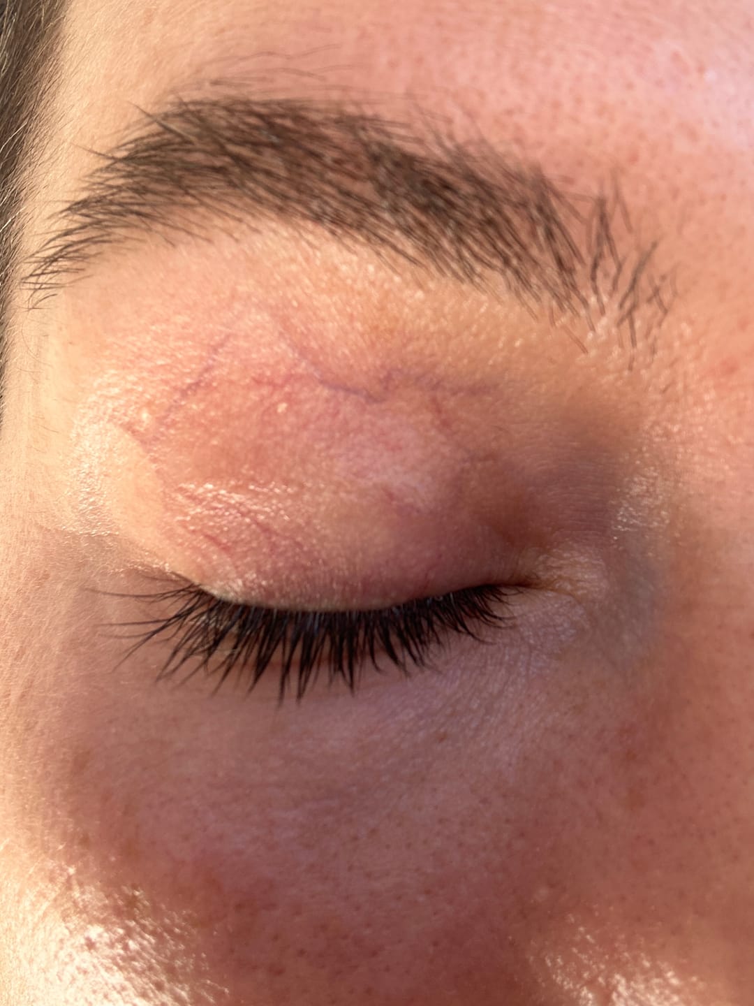 Customer photo review of KosmaLash® | Sérum Crecimiento & Anticaída