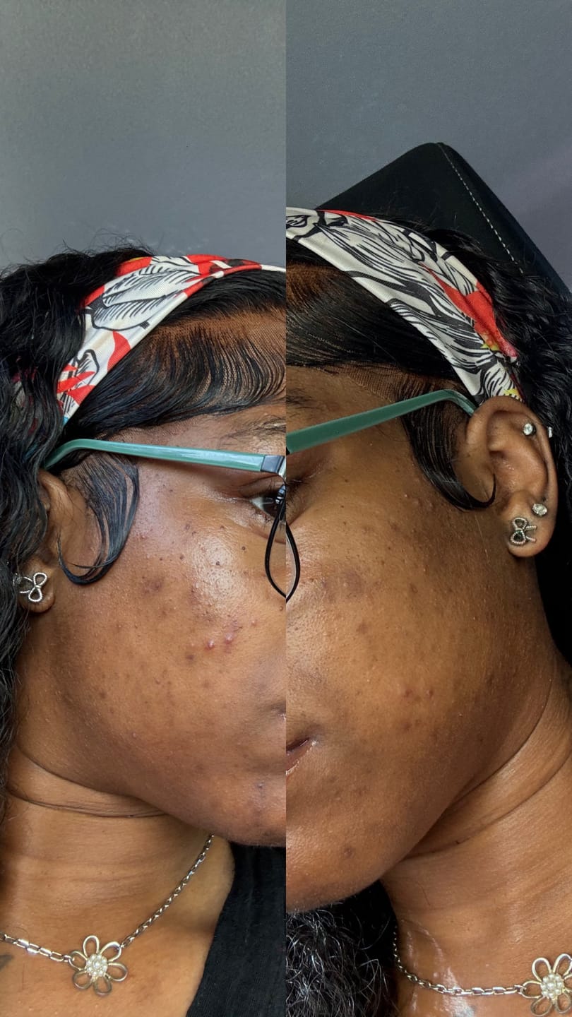 Customer photo review of Duo Skincare Bundle