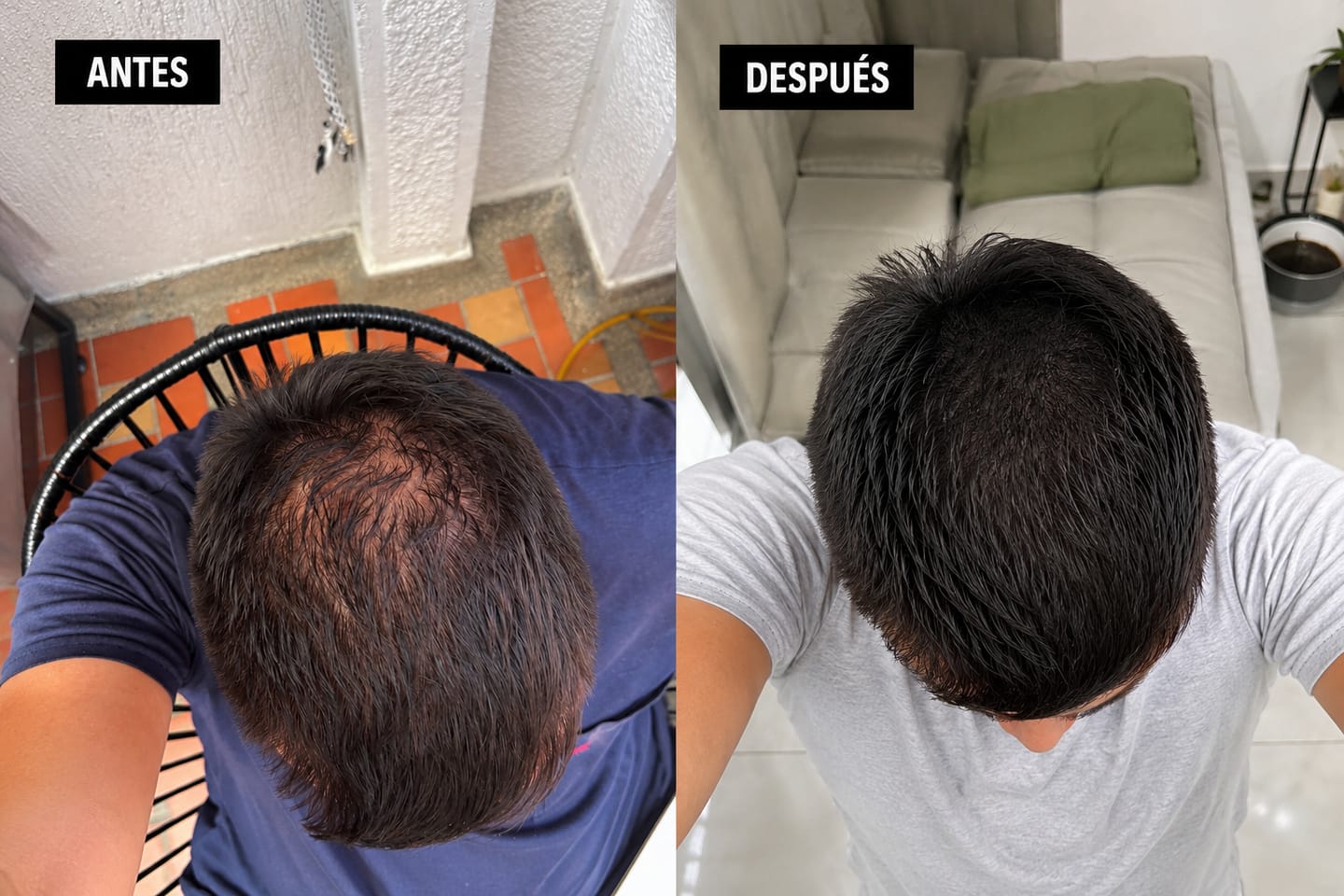 Customer photo review of Hair Tonic | Crecimiento Capilar 2X1