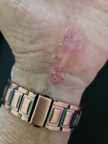 Customer wearing copper magnetic bracelet