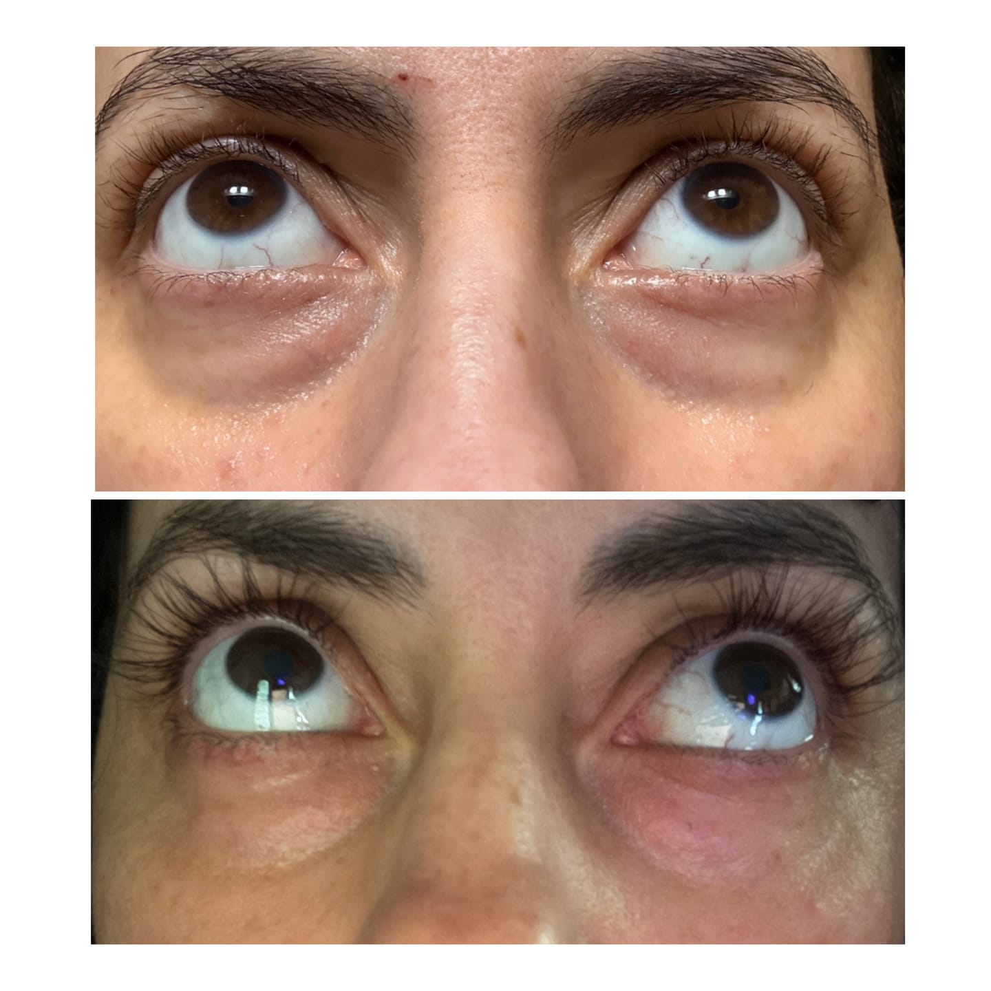 Customer photo review of fLASH EYELASH SERUM