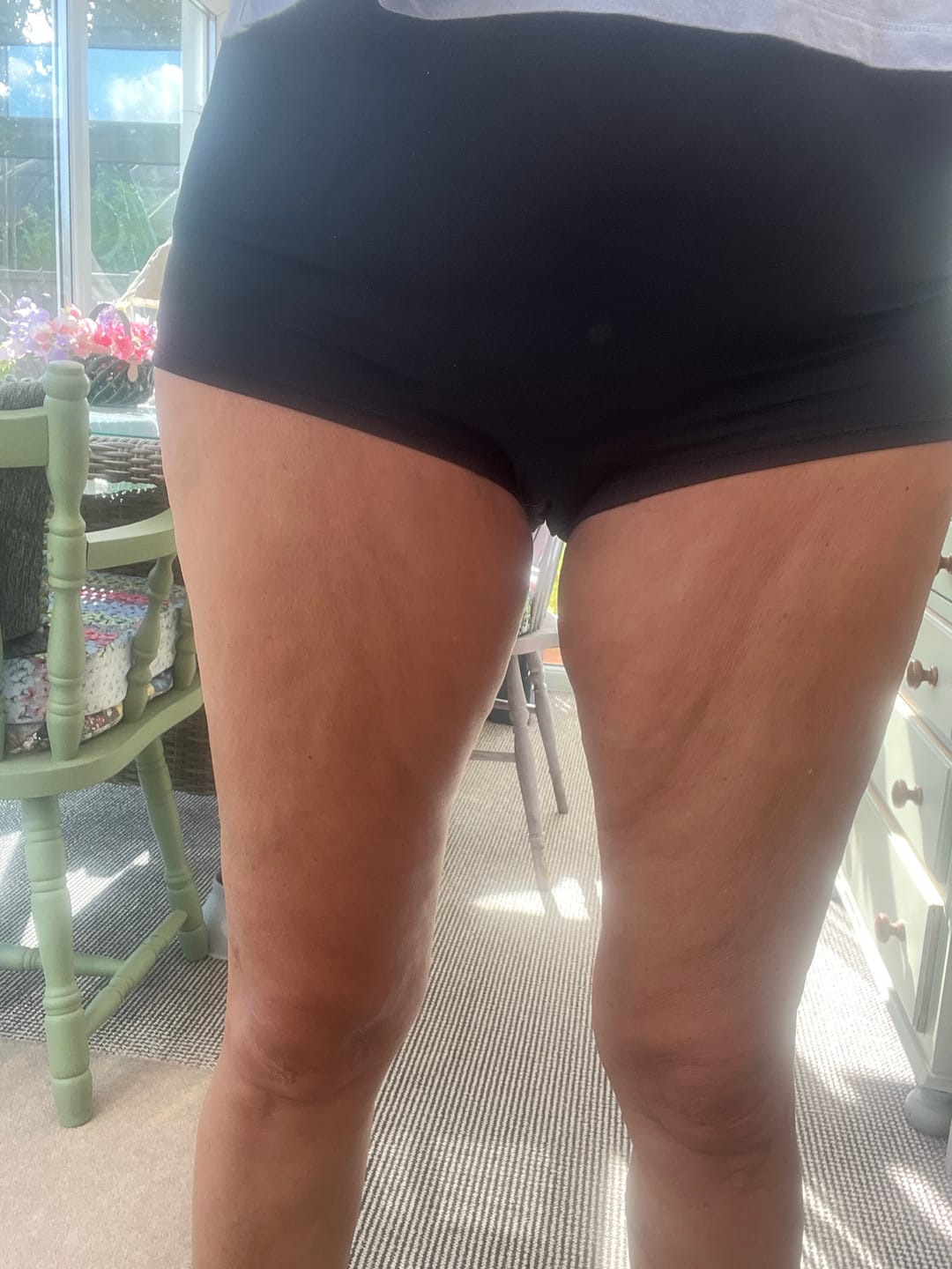 Customer photo review of Body For Us Anti-Cellulite Massage Oil