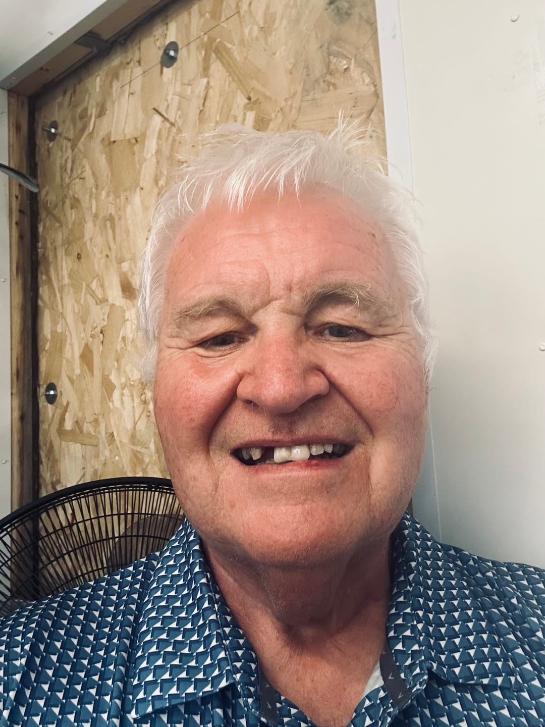 Customer photo review of Click-in Veneers 4.0
