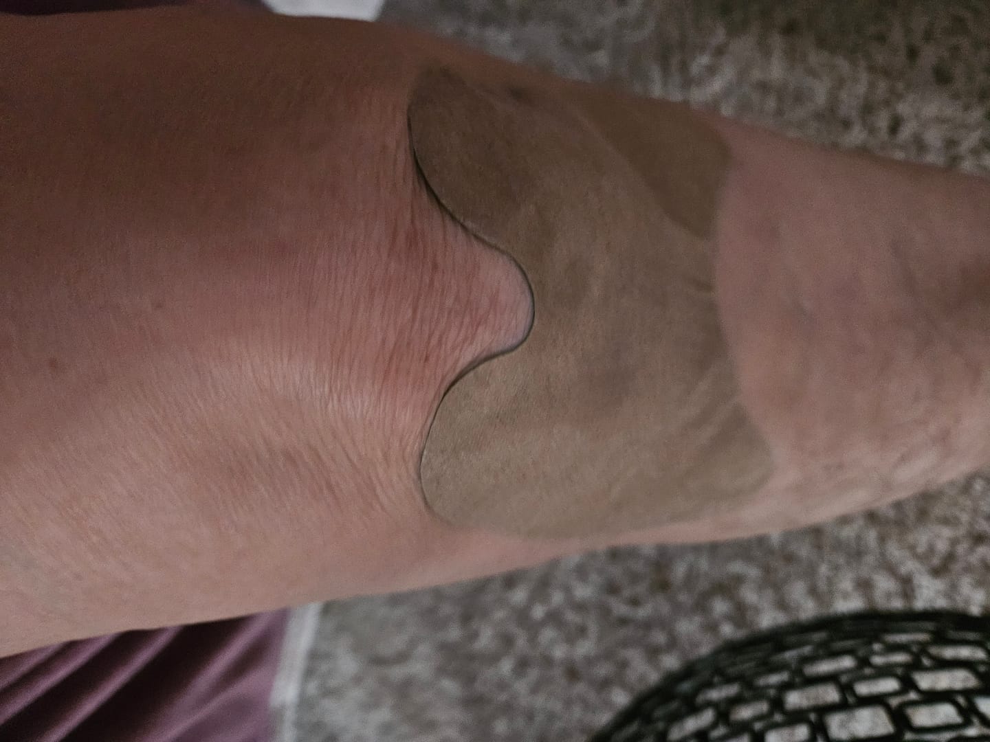 Customer photo review of Auxilium Knee Patch (fka Heaven Patch)