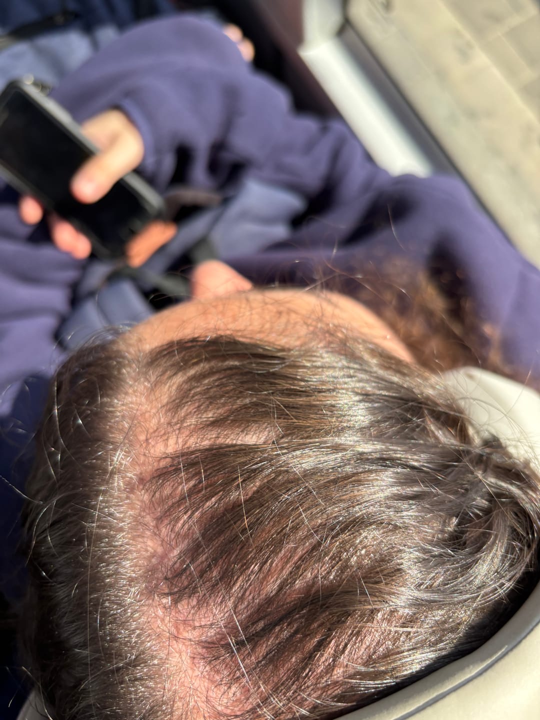 Customer photo review of VITAFOAM ™ Hair Growth Formula