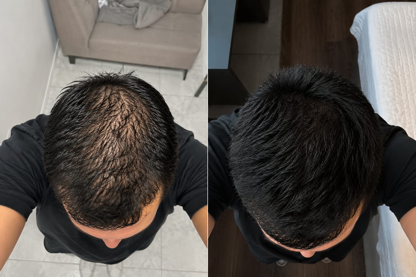 Customer photo review of Hair Tonic | Crecimiento Capilar 2X1