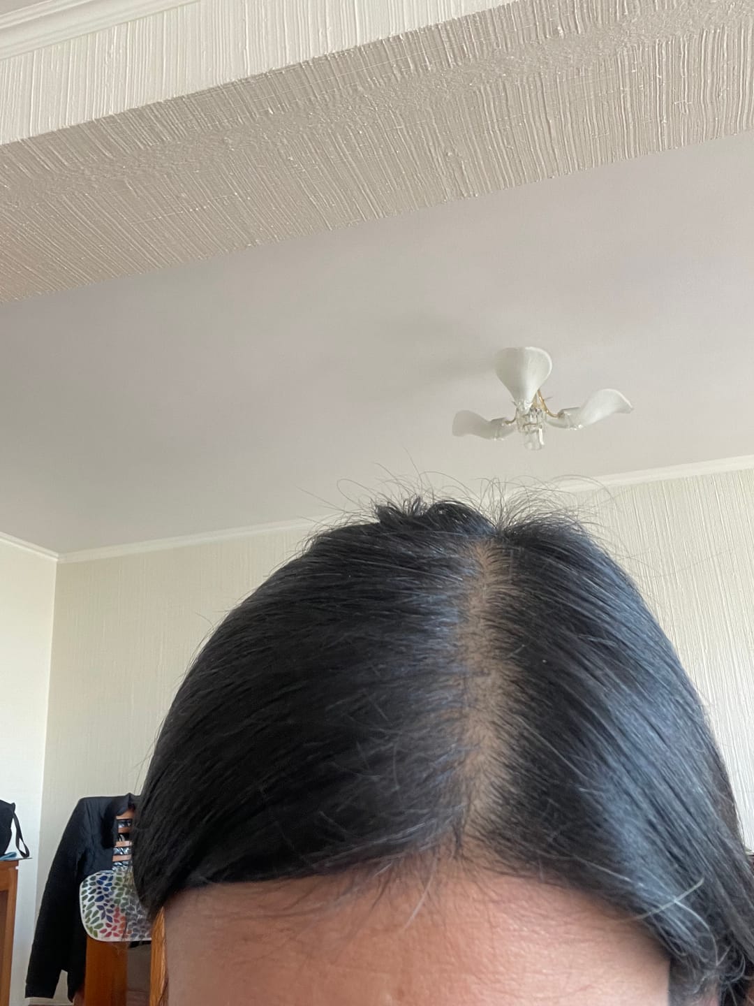Customer photo review of BOMBA NUTRICIONAL PELO, PIEL Y UÑAS  - 30 CÁPSULAS