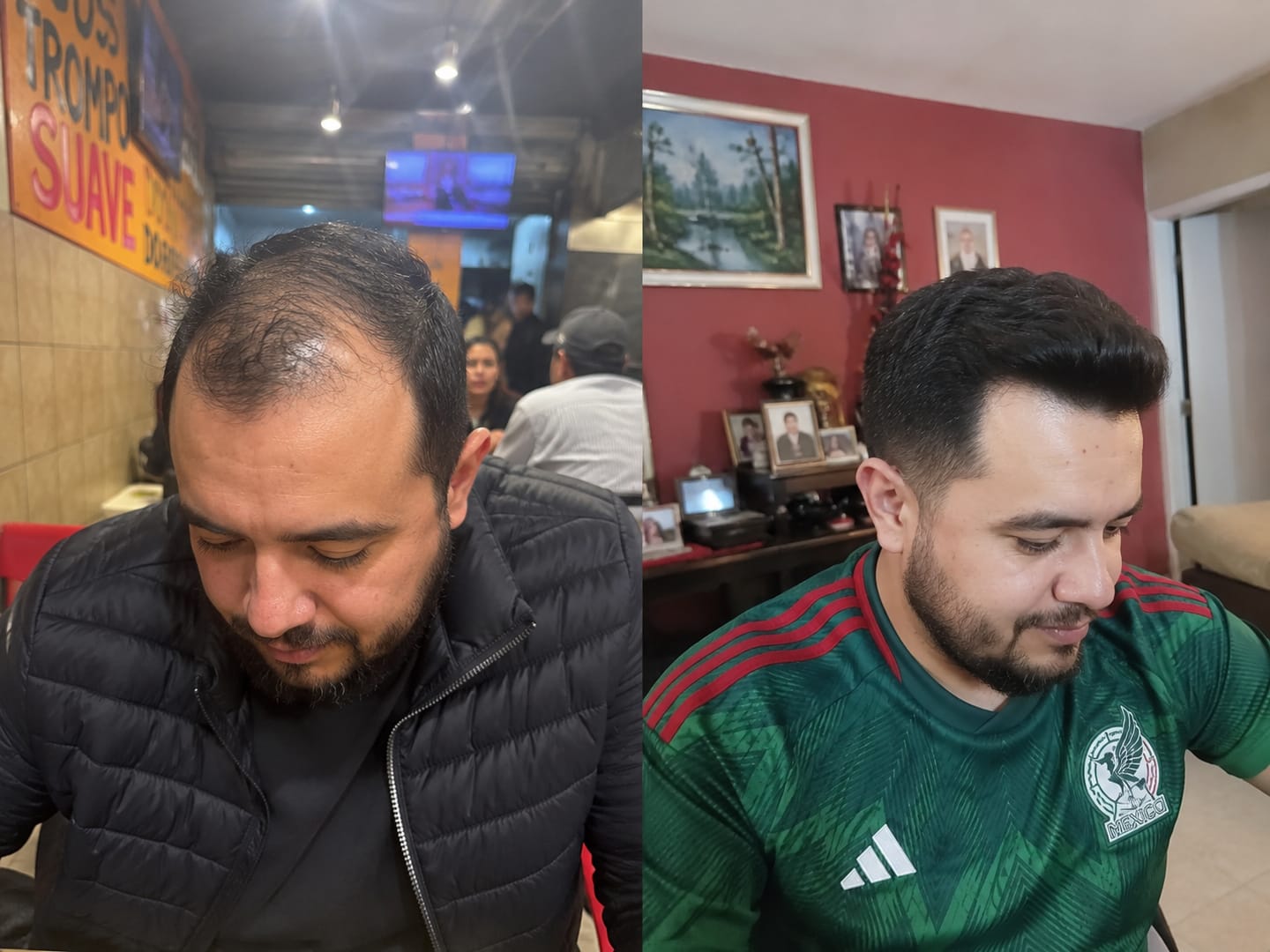 Customer photo review of Hair Tonic | Crecimiento Capilar 2X1