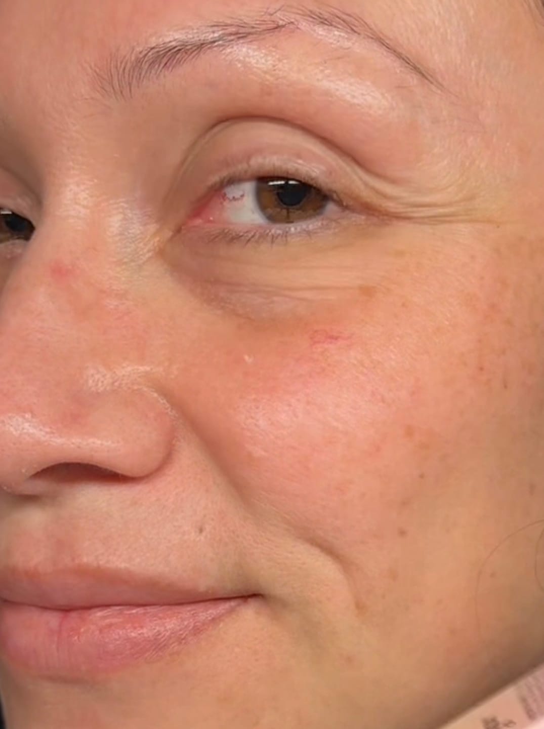 Customer photo review of Eyelash Serum