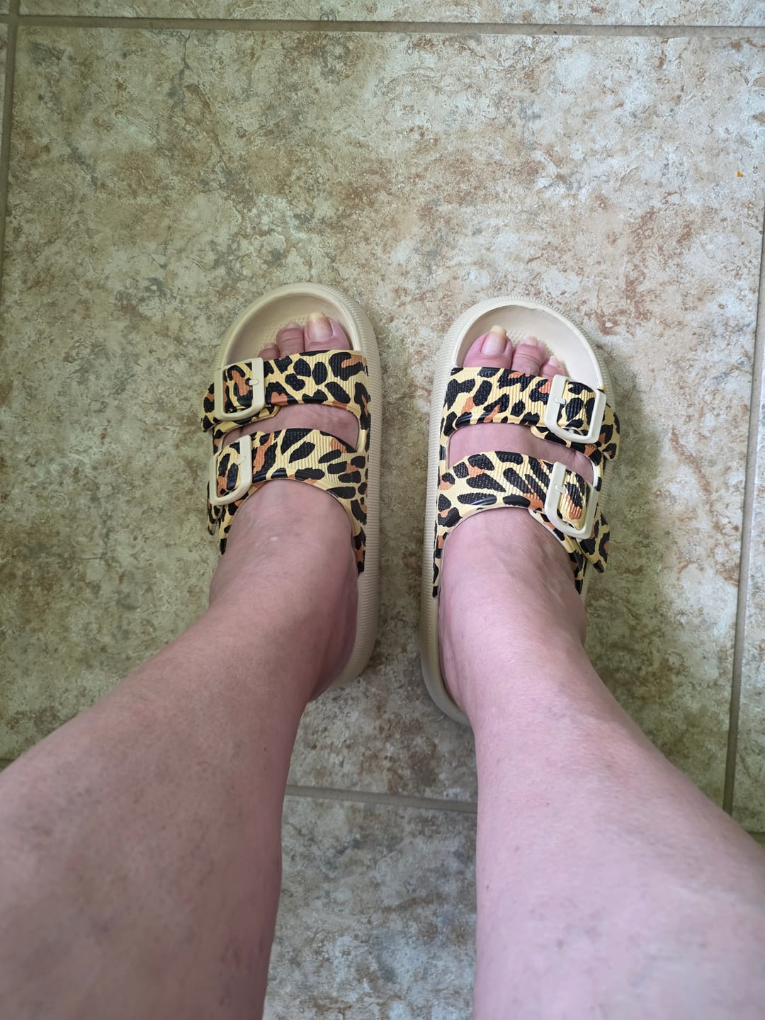 Customer photo review of Cloud Slides - Cushioned EVA Sandals with Adjustable Buckles