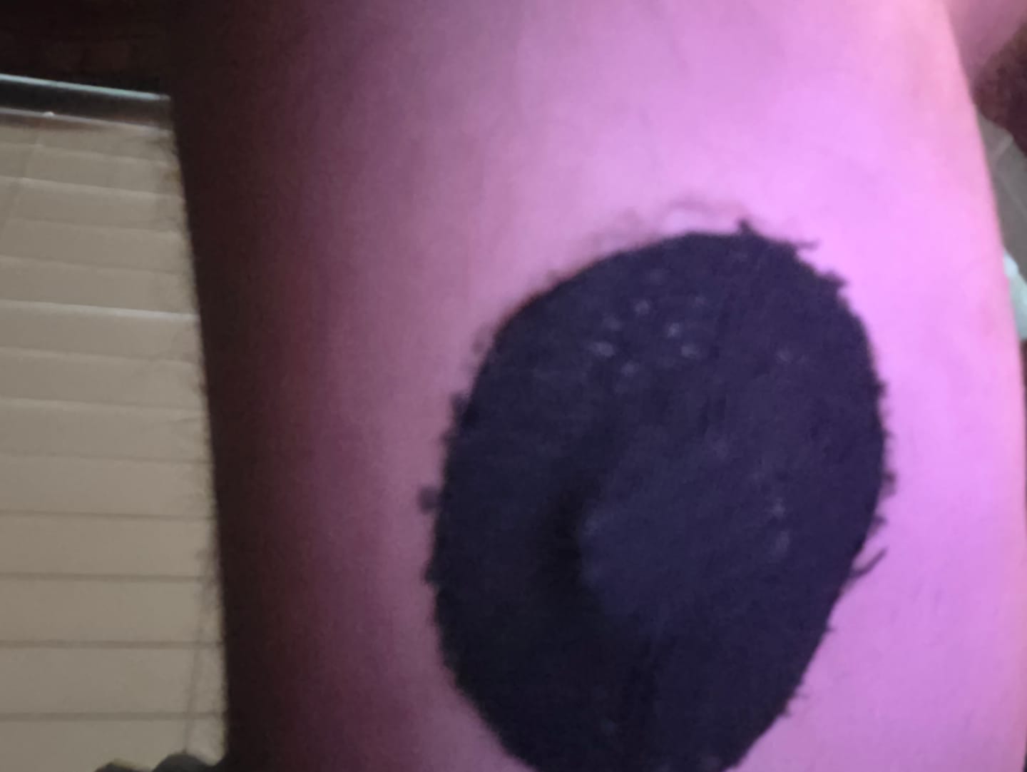 Customer photo review of Skin Grip Original - Libre 3+ Adhesive Patches