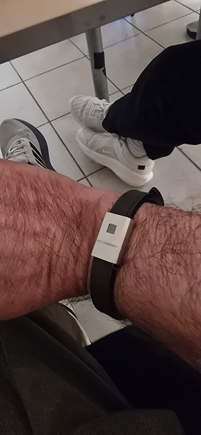 Customer photo review of Stability Bracelet