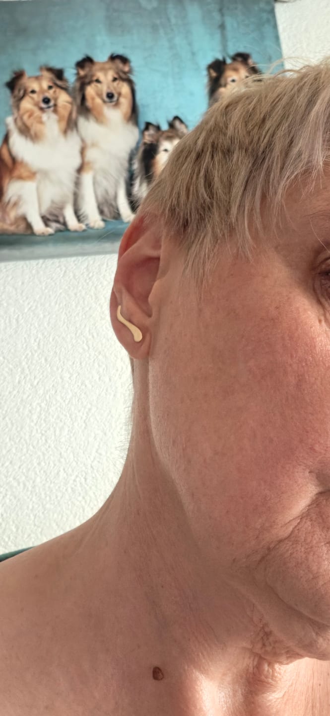 Customer photo review of Rise Ear Climber