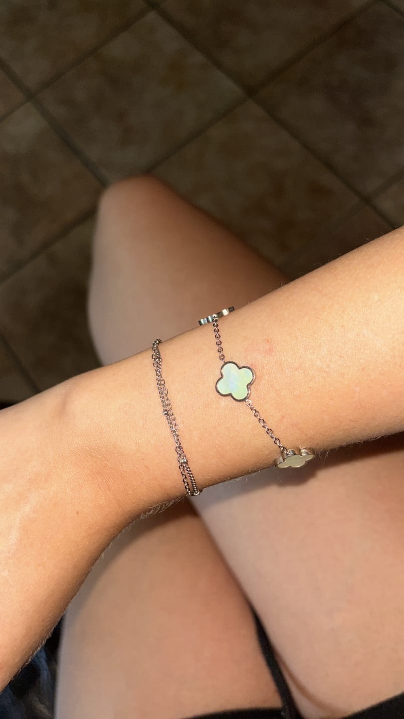 Customer photo review of Spotlight Armband Set