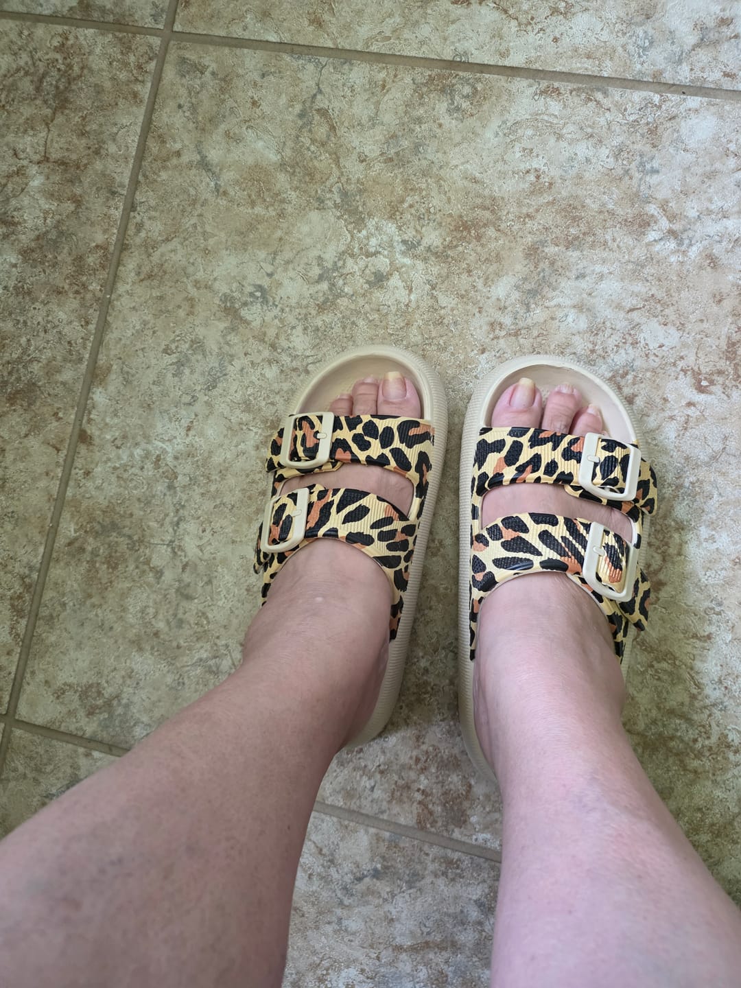 Customer photo review of Cloud Slides - Cushioned EVA Sandals with Adjustable Buckles