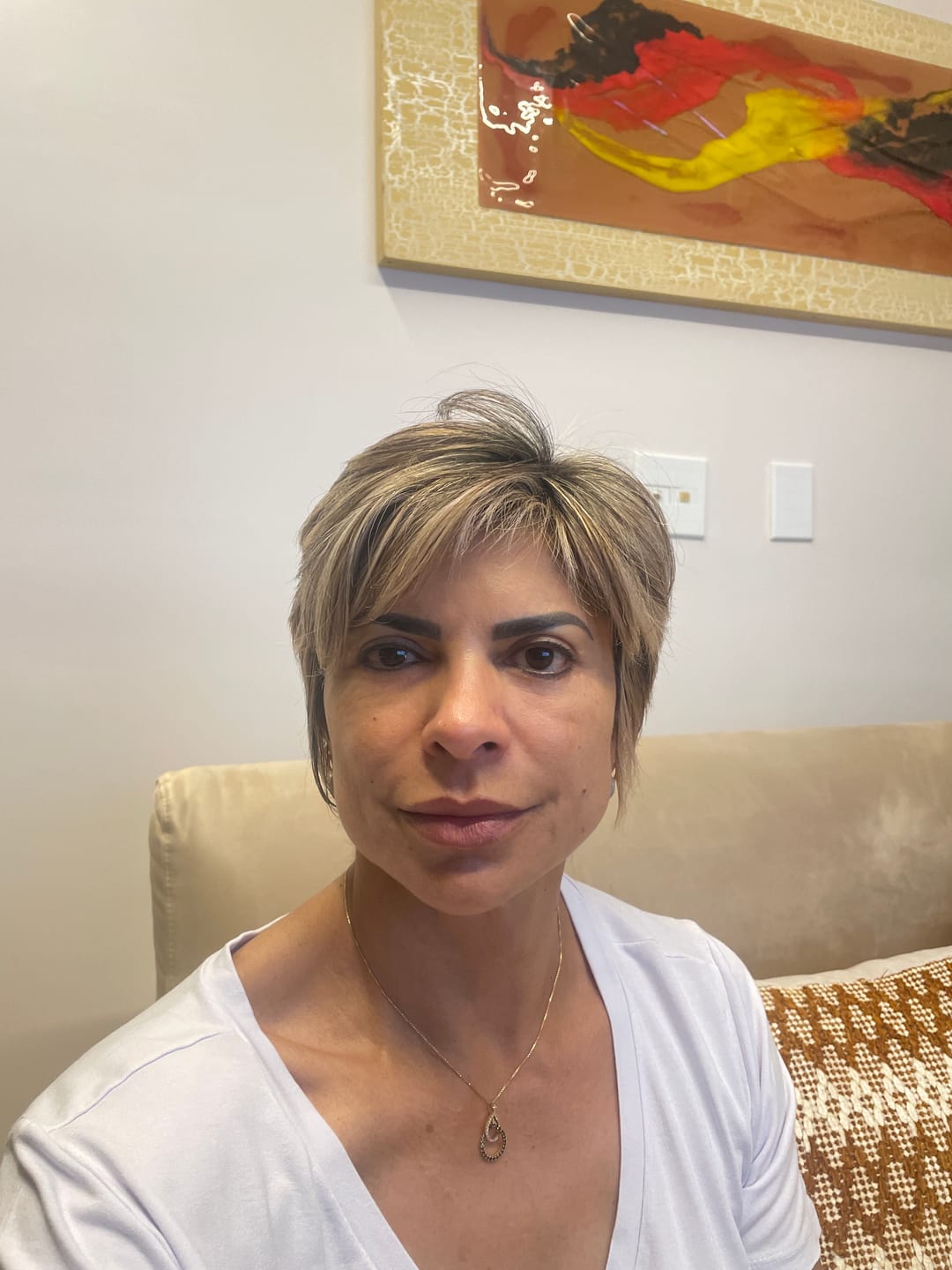 Customer photo review of Solução Exossomos + PDRN + Peptídeos