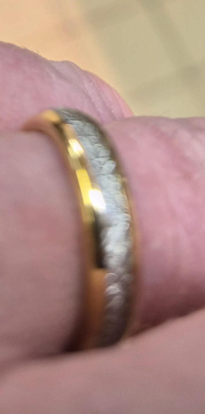 Customer photo review of The Golden Steel Wonder Ring Set