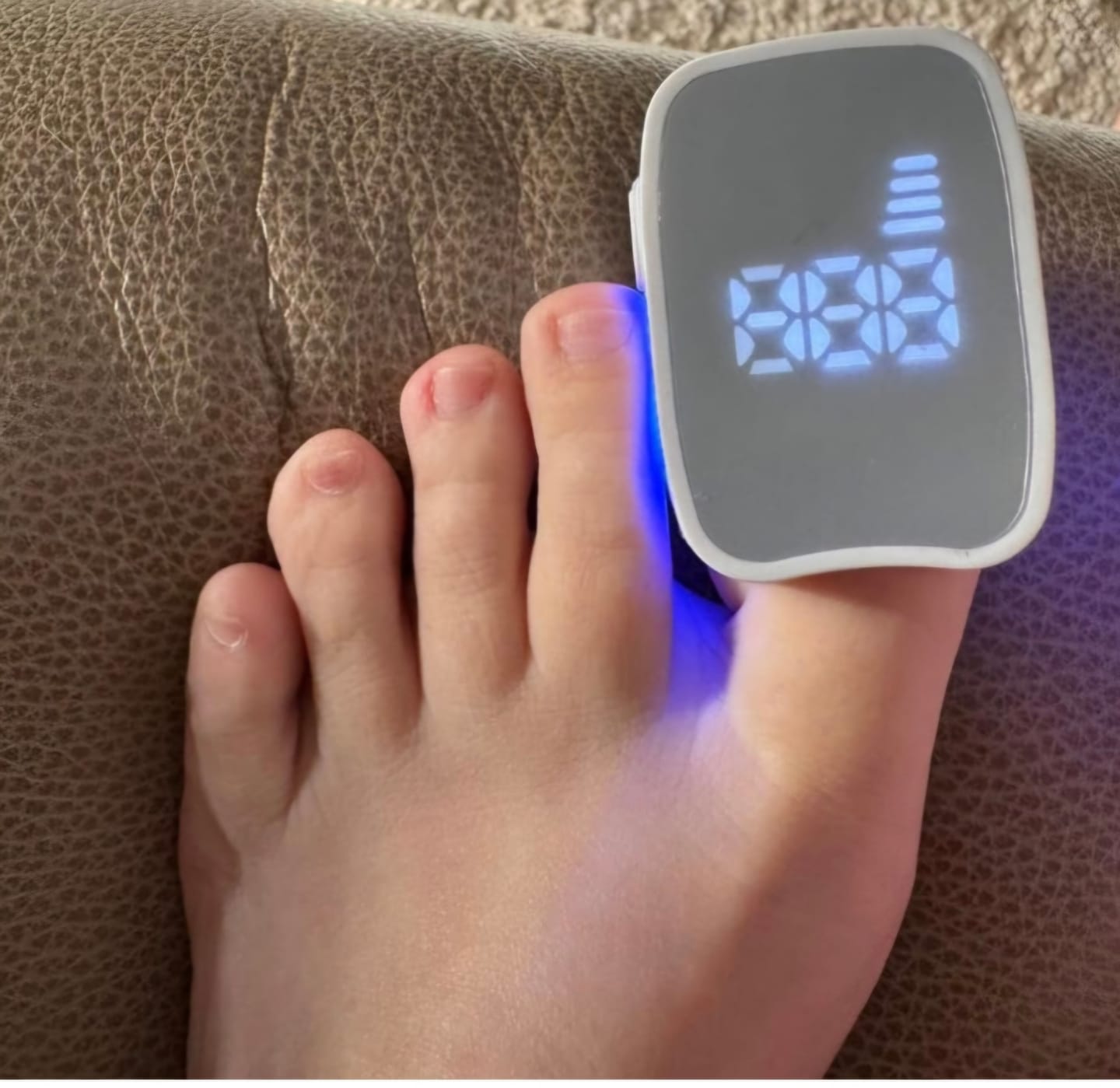 Customer photo review of Antifungal Laser Enhancer körömgomba elleni ecsetelő