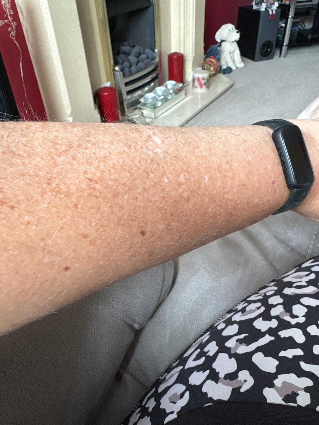 Customer photo review of Self Tanning | 150 Capsules
