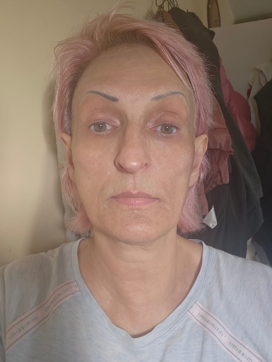 Customer photo review of Peel Shot Пилинг Ампула с Бял Ориз
