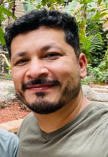 Customer photo review of Minoxidil al 20% | Espuma para Crecimiento de Barba. Formula Mejorada.