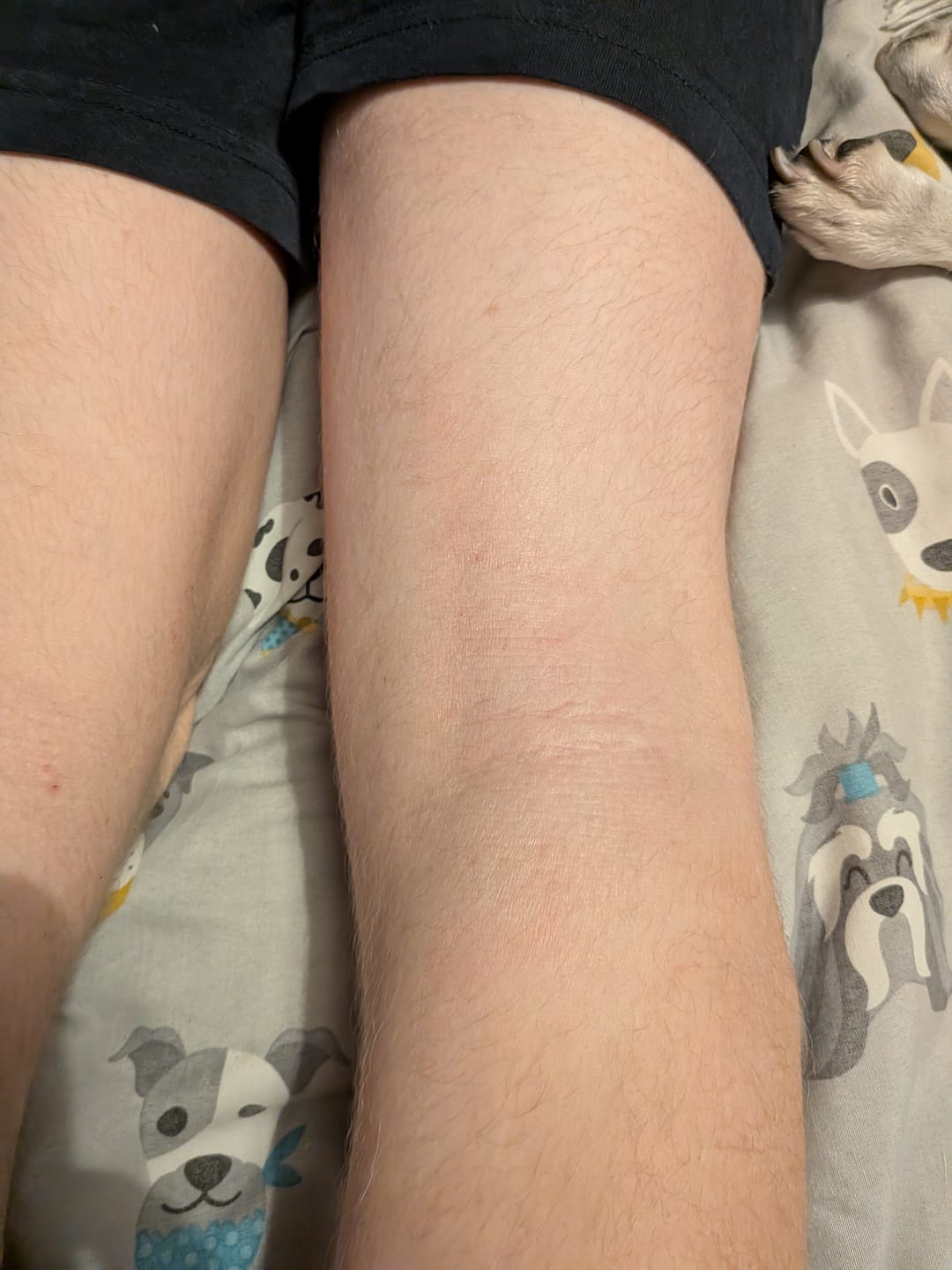 Customer photo review of Bioskin Duo Pack