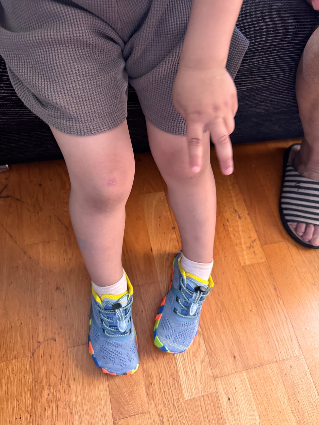 Customer photo review of Niños Smart Ⅰ - Zapatos Barefoot