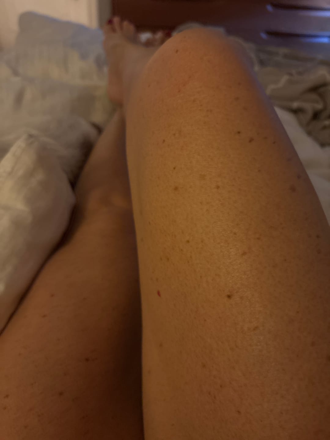 Customer photo review of Crema ricompattante corpo