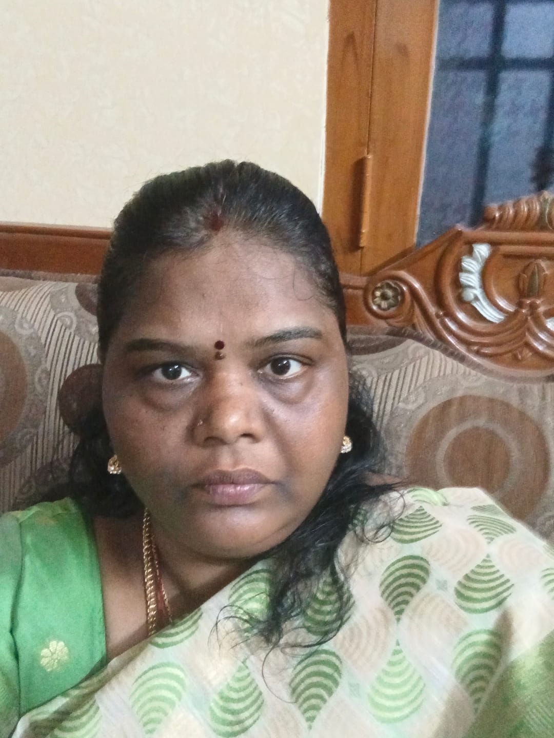Customer photo review of Ujvala Skin Brightening Moisturizer