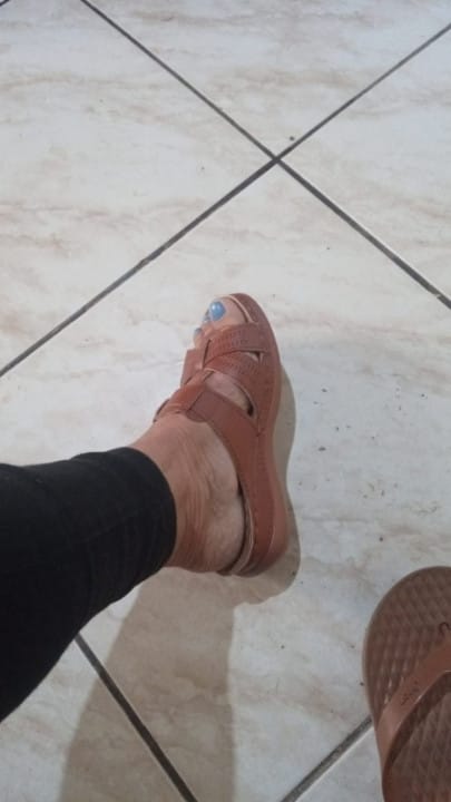 Customer photo review of Sandales orthopédiques Premium