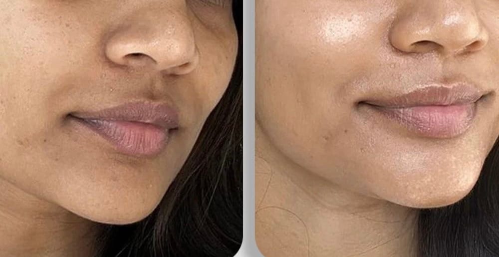 Customer photo review of Ultra Whitening Serum