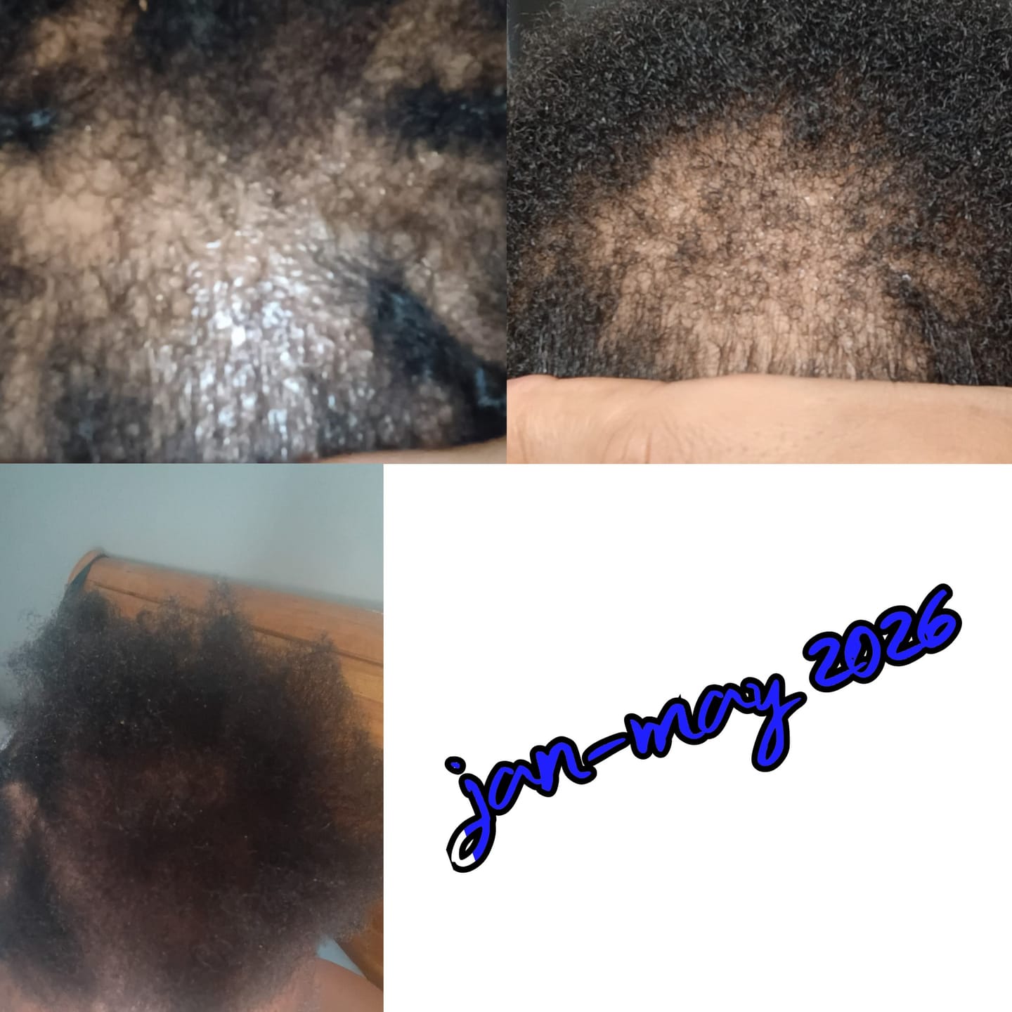 Customer photo review of BALM- Stimulating Scalp and Hair Balm