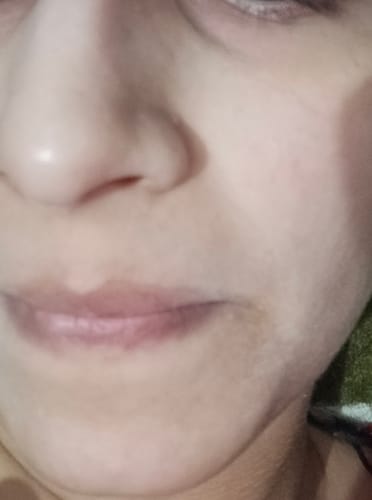 Close-up of a reviewer's lips and skin showing the results of using the Lip Cream.