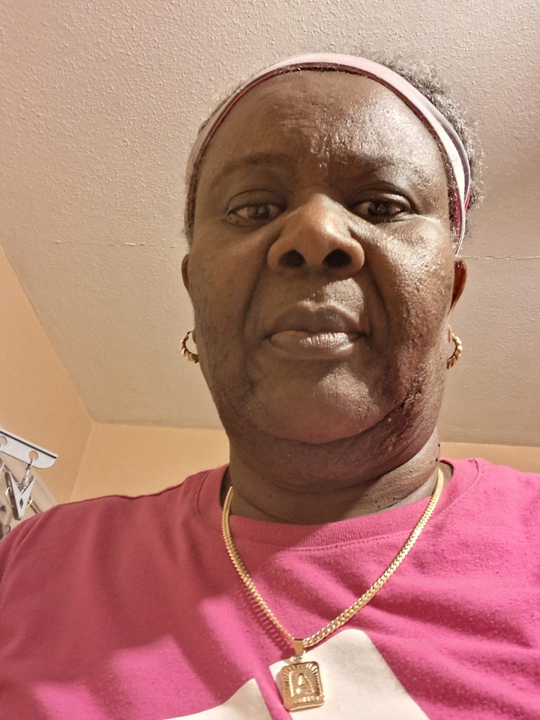 Customer photo review of Turmeric Fade & Glow Bar.