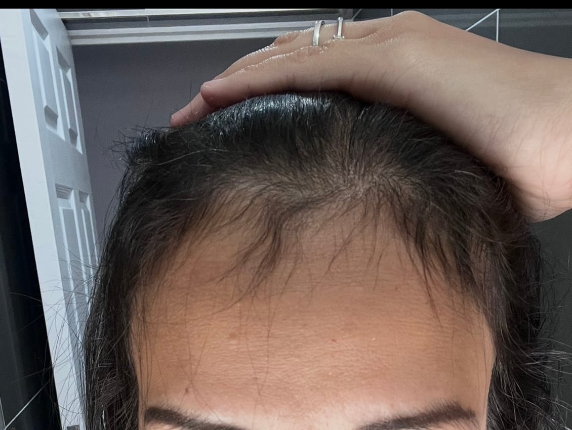 Customer photo review of DEEPLY ROOTED – Advanced Nutraceutical Hair Growth Formula