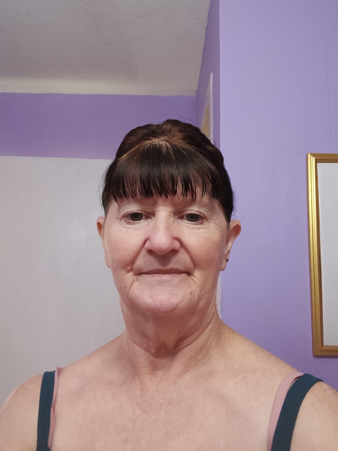 Customer photo review of Koriderm™ Time Reverse Cream (All-In-One)