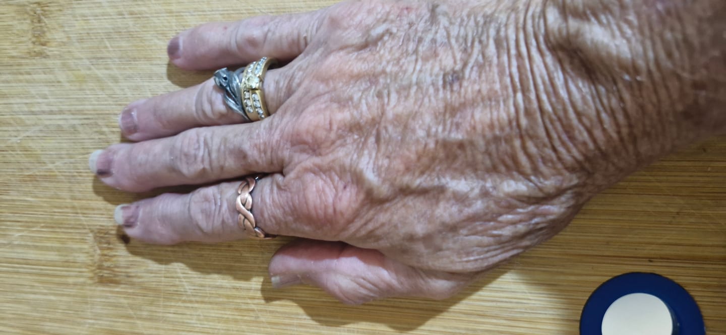 Customer photo review of Mens Adjustable Copper Magnetic Ring