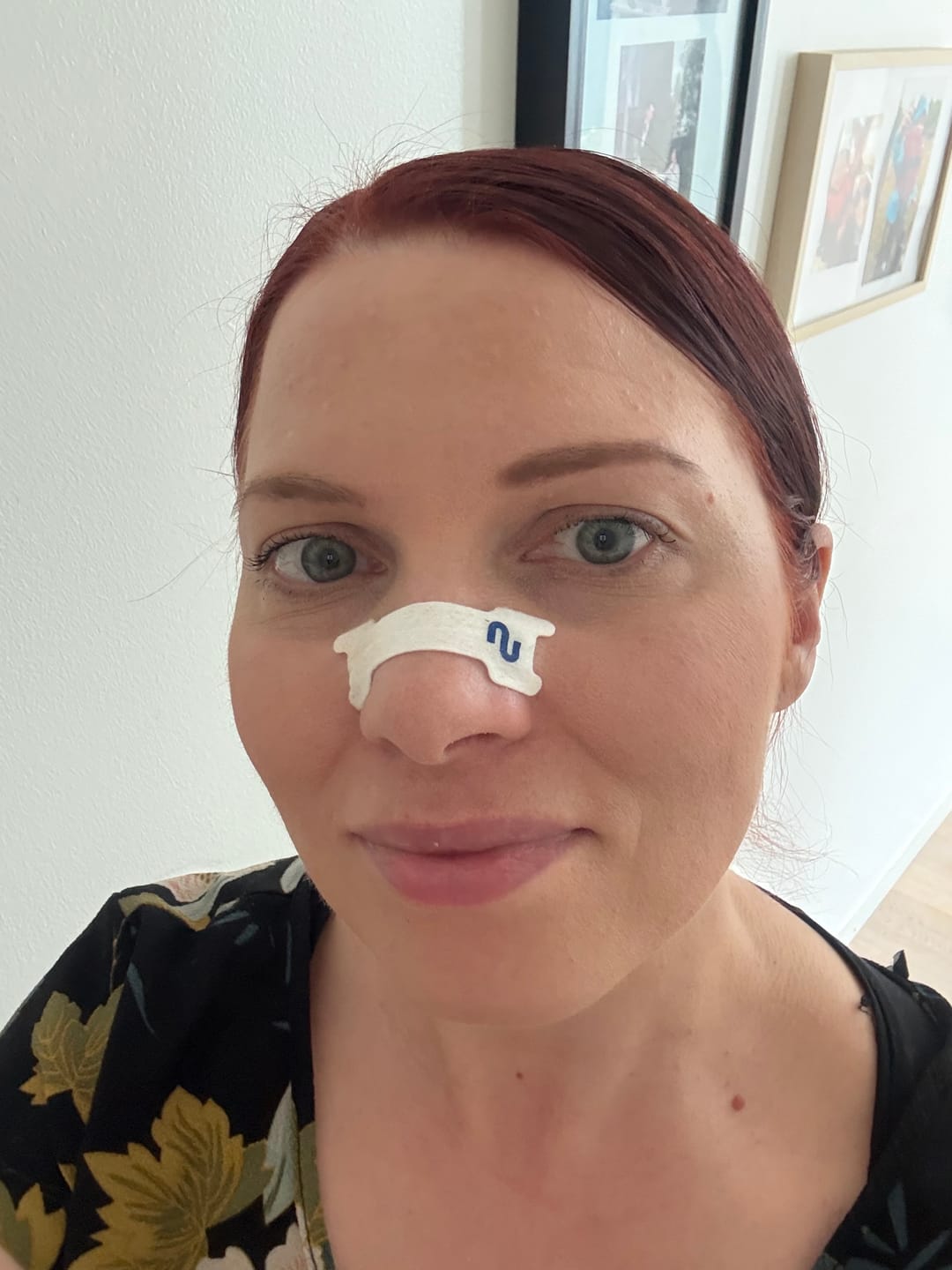 Customer photo review of Nuku Sleep Nasal Strips