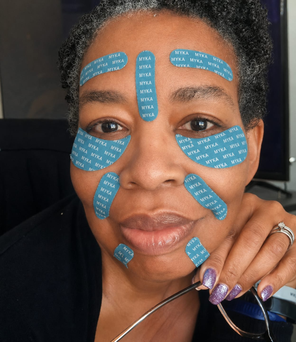 Customer photo review of Patch Skinjection aux peptides — Visage & Contour des yeux