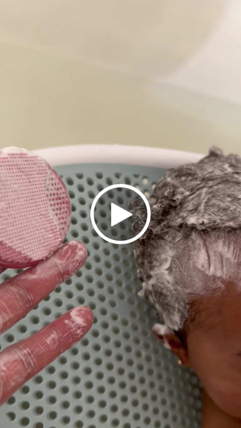 Customer video review of HOLISTIC NATURAL BABY BAR (Cradle Cap Treatment for Babies, Soothes Babies Scalp, Prevents Dryness and Flakes)