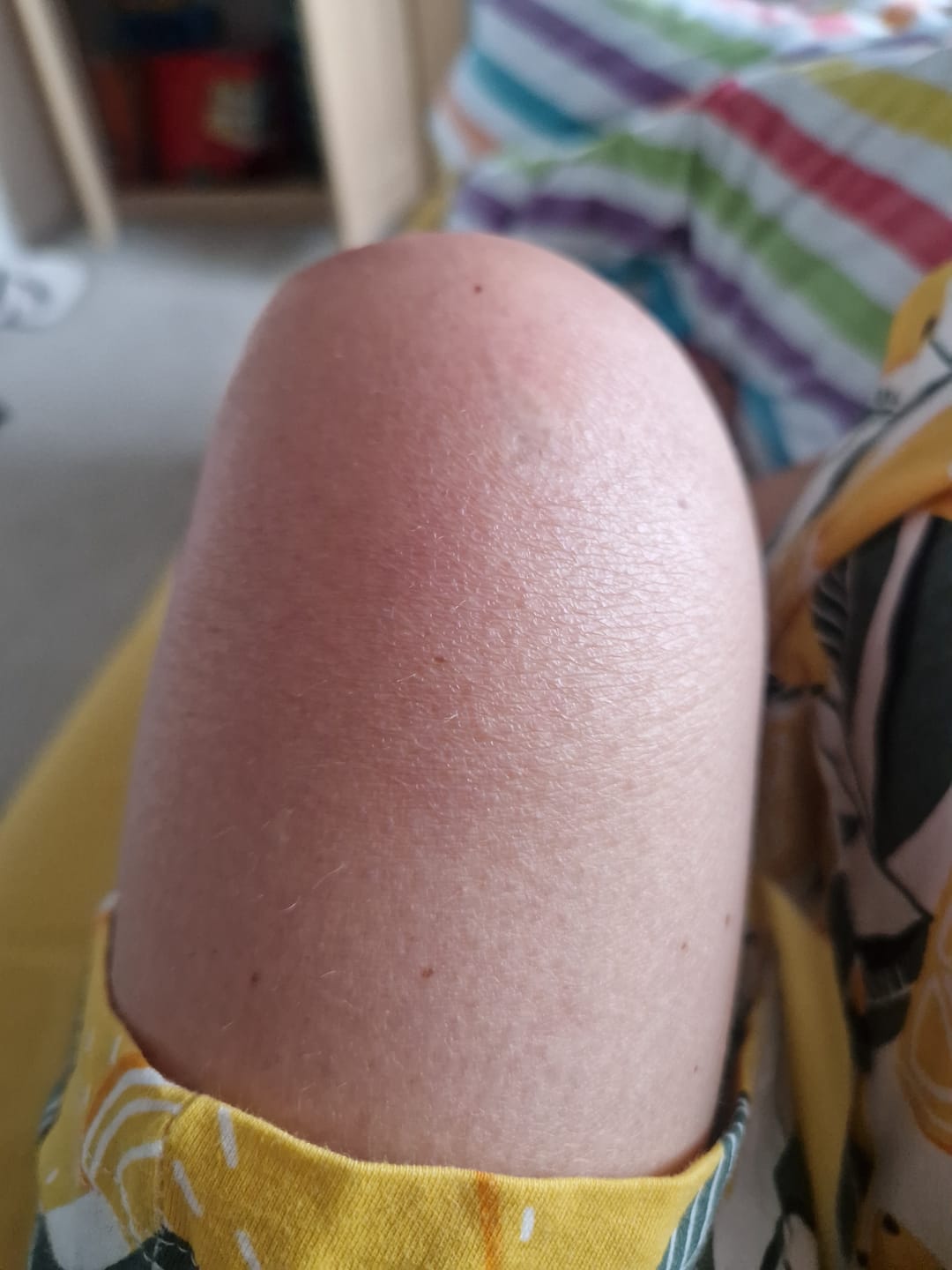 Customer photo review of 30 Days Of Age Defying Multi-Collagen
