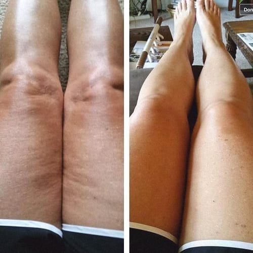 Customer photo review of Legging anti-cellulite Sleemz™