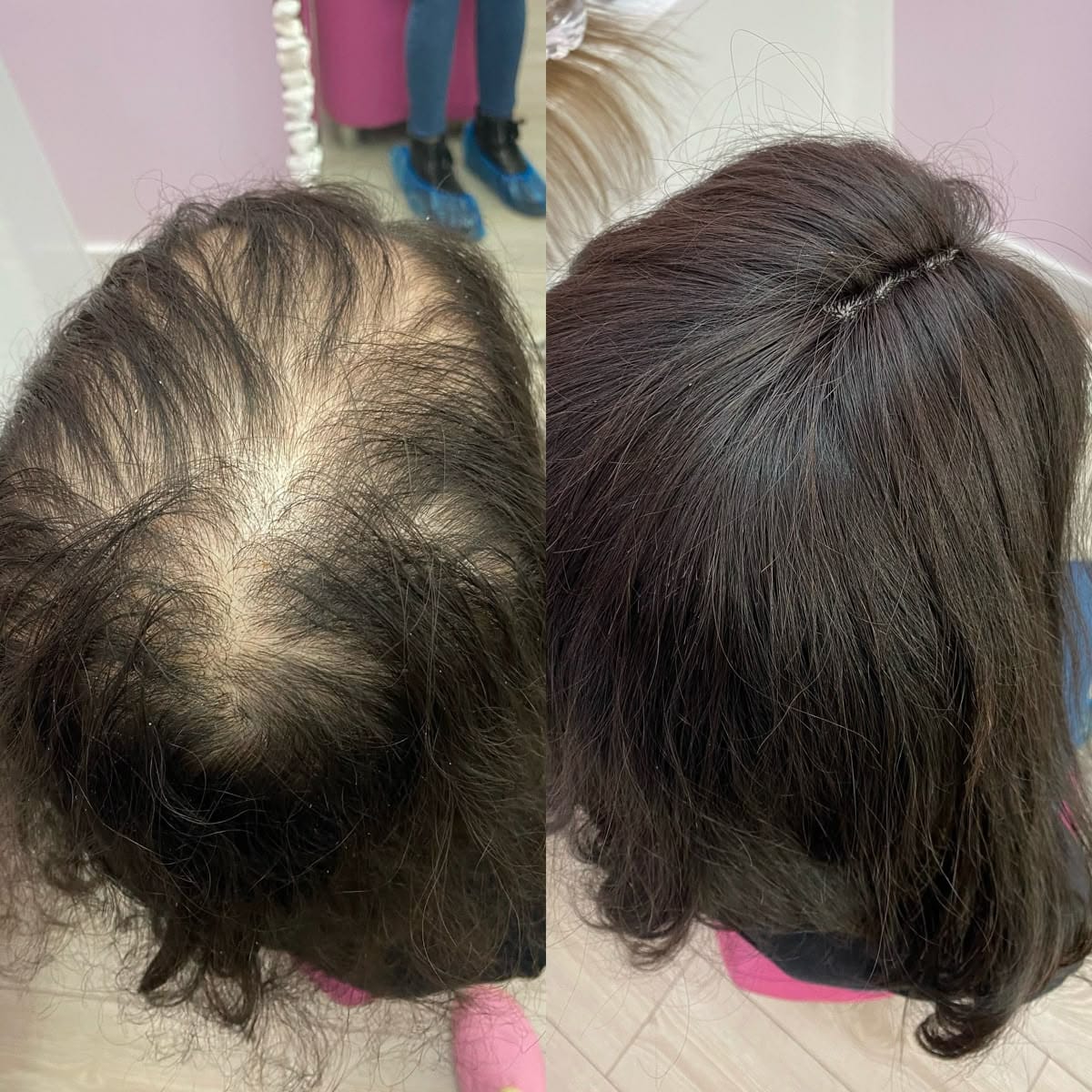 Customer photo review of Pépins de Courge